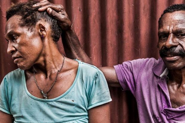 A husband shows his wife's disfigured ear. Port Moresby. Source: Vlad Sokhin. 